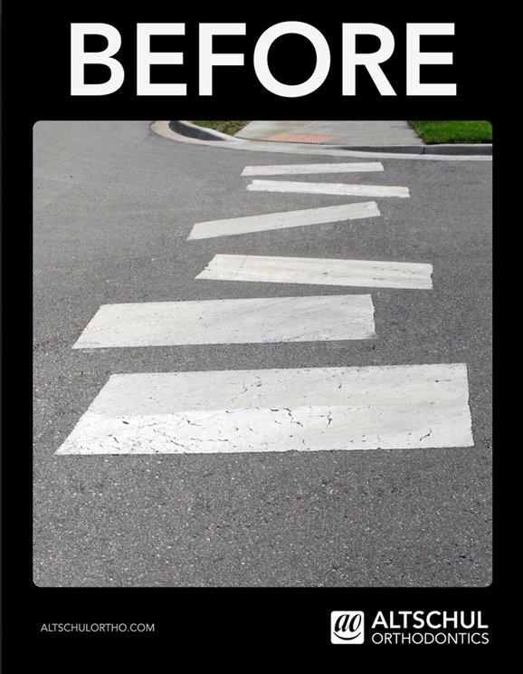 Altschul, l'ortodonzia che raddrizza tutto