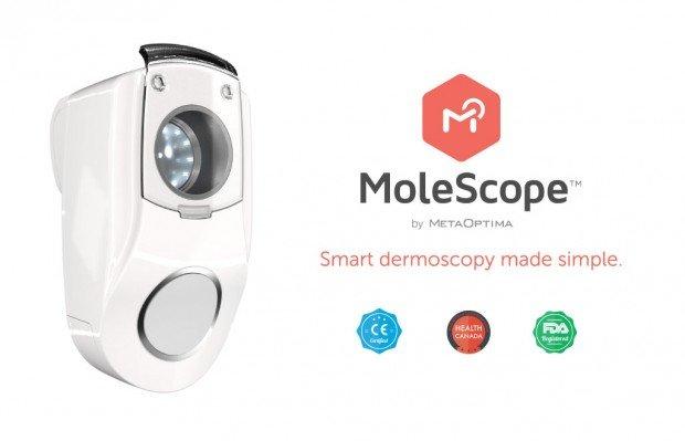 MoleScope, quando lo smartphone parla al vostro dermatologo