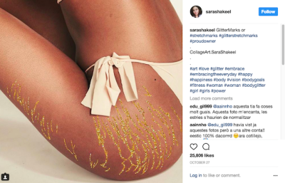 La nuova (meravigliosa) tendenza: esaltare le smagliature con l’oro